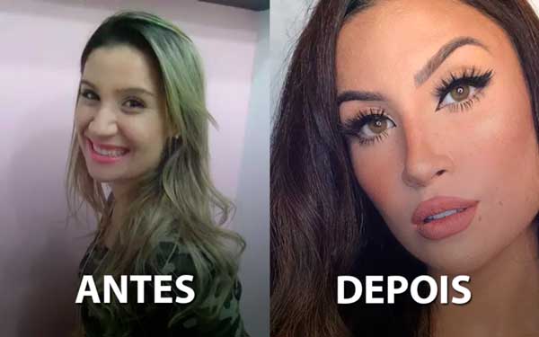 BIANCA ANDRADE ANTES E DEPOIS DAS CIRURGIAS PLASTICAS