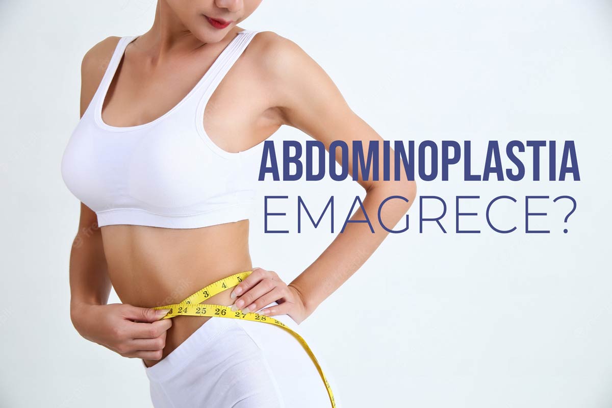 Abdominoplastia emagrece? Quantos quilos vou emagrecer com a abdominoplastia?