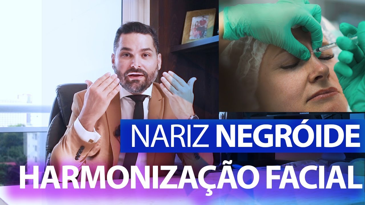 Harmonização Facial Em Nariz Negroide | Rinomodelação em Nariz de Batata (bulboso)