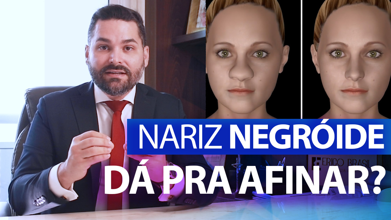 Dá pra afinar Nariz Negroide? Cirurgia plástica para deixar nariz negroide mais fino