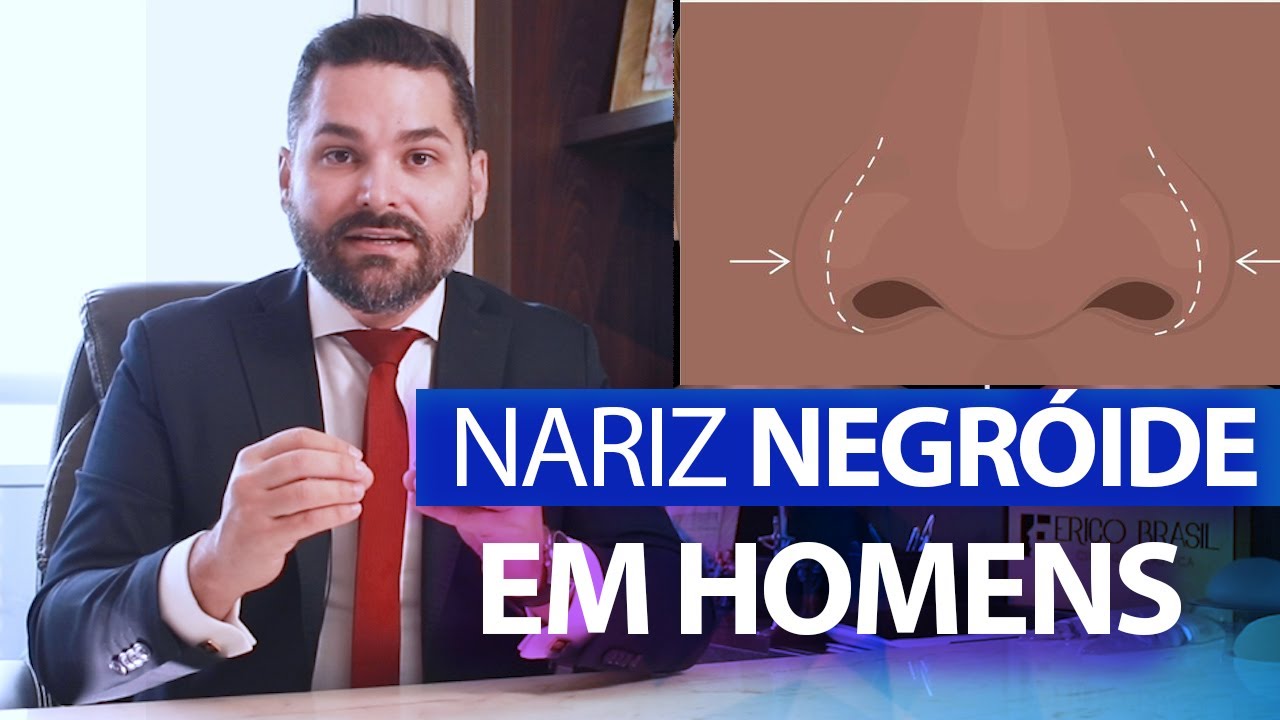 Nariz negroide em Homens | Cirurgia plástica de nariz em homens com nariz bulboso (batatinha)