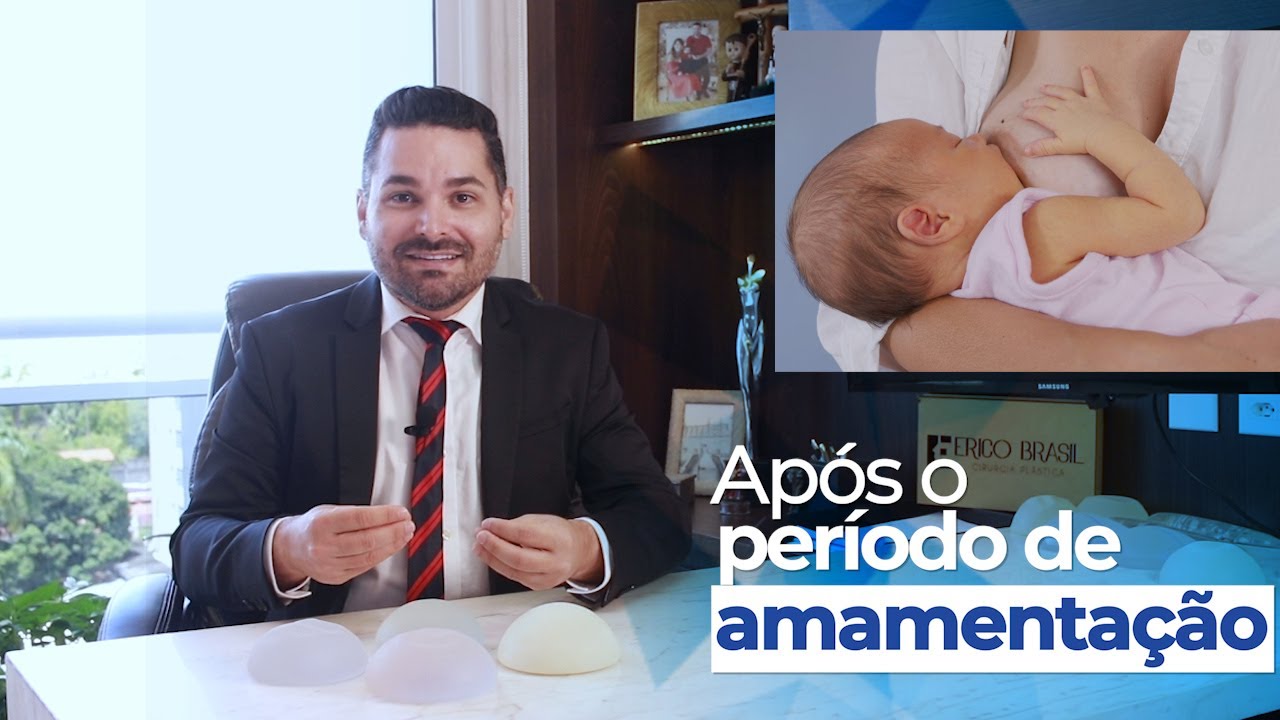 Mastopexia e Amamentação. Quanto tempo após a amamentar eu posso fazer cirurgia plástica para levantar os seios?