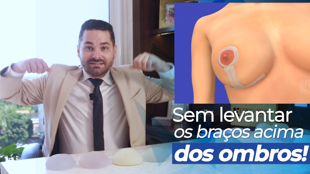 Quanto tempo depois da MASTOPEXIA posso levantar os braços?