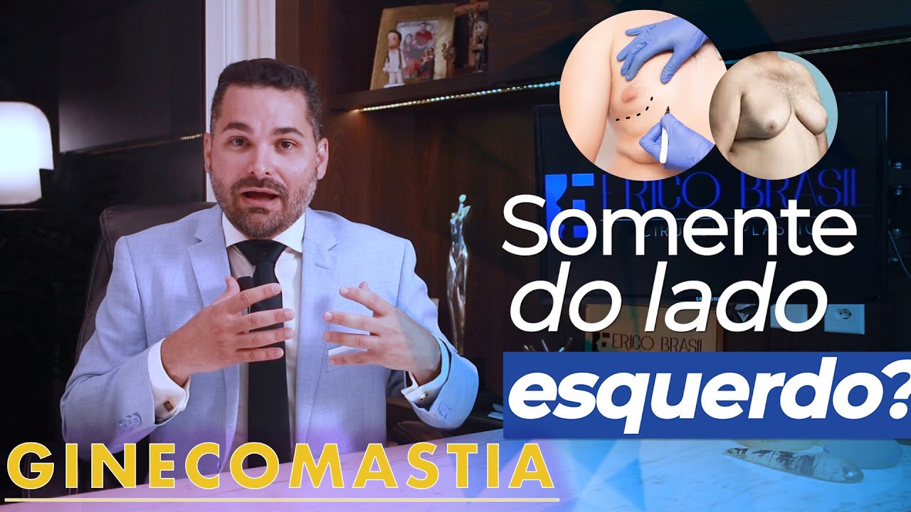 Ginecomastia a esquerda | Ginecomastia somente do lado esquerdo